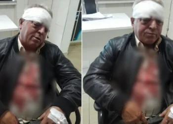 Tronditëse! Rrihet në mënyrë c’njerëzore punonjësi i Pastrimit, ja cfarë raportohet