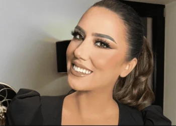 Arbana Osmani nuk fshihet më, tregon ndërhyrjet estetike që ka kryer! (Foto)