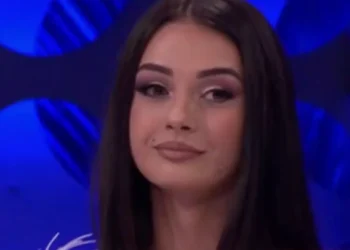WOW nuk njihet më! E mbani mend Ana Kaurin, ndërhyrjet kirurgjikale e kanë bërë me një tjetër fytyrë (Foto)