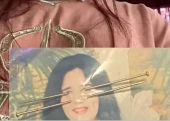 TR0NDITESE! I bënë magji me foton e saj, e reja pëson deformime drastike në pamje (FOTO)