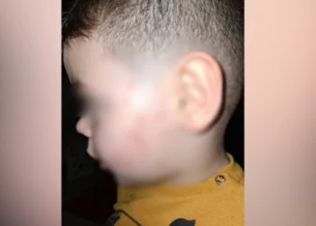 Ndodh sërish! Edukatorja dh*non 3 vjecarin në tiranë, drejtoresha e kopshtit “i lë” nënës Zotin: Allahu të ta marrë hakun