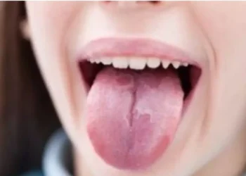 Ju thahet goja shpesh? Ja si te gjeni zgjidhje me kura natyrale ne kushte shtepie…