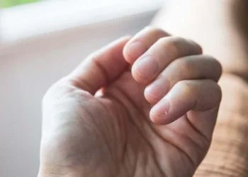 Pesë shenja që ju japin duart kur keni problem me tiroiden